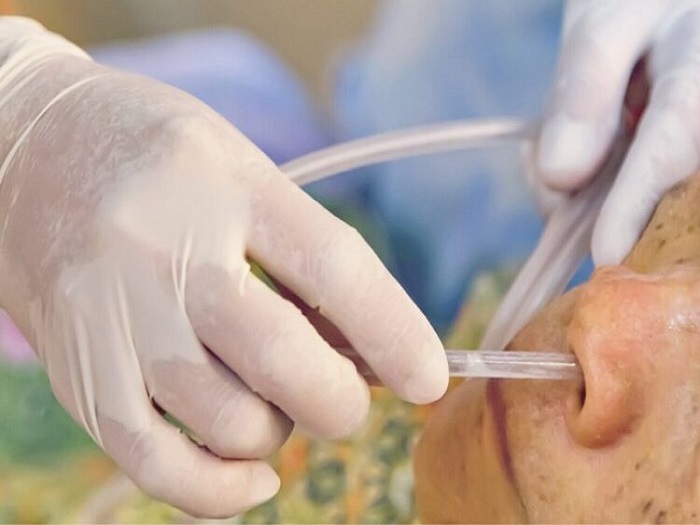 Ryles Tube Insertion at Home In Dehradun